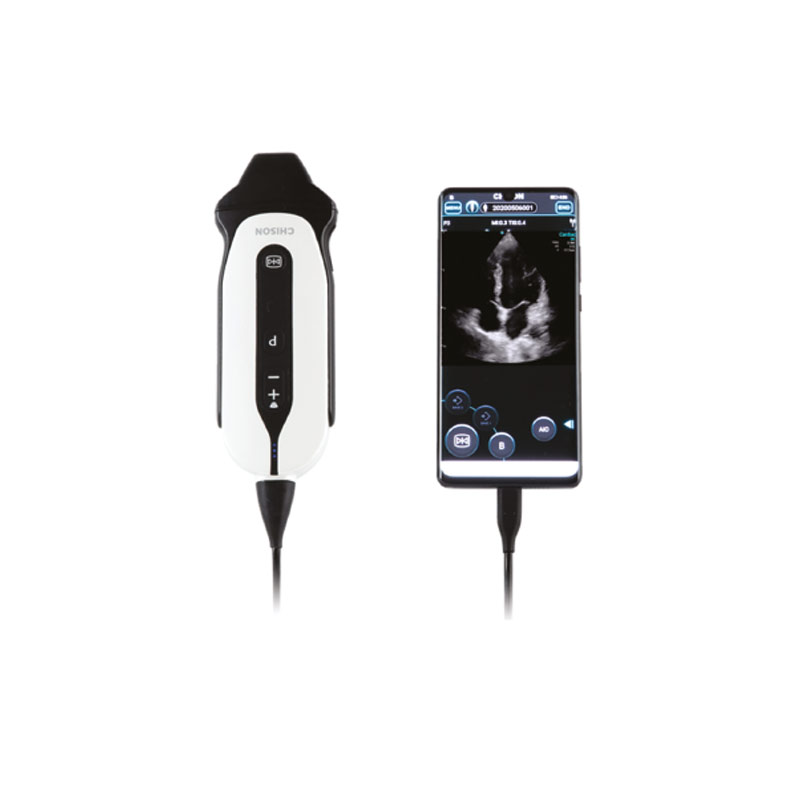 SonoEye Handheld Ultrasound